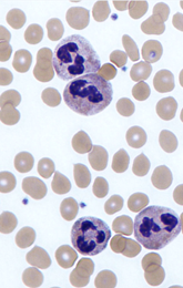 Microscopic image of neutrophils in blood