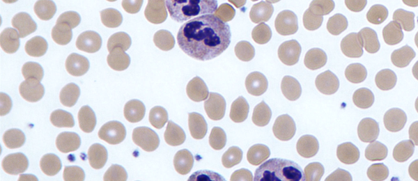 Microscopic image of neutrophils in blood